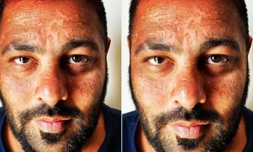 बॉलीवुड के रैप सिंगर बादशाह के चेहरा हुआ खराब ,पहचान नहीं पाओगे बॉलीवुड के रैप सिंगर बादशाह के चेहरा हुआ खराब ,पहचान नहीं पाओगे