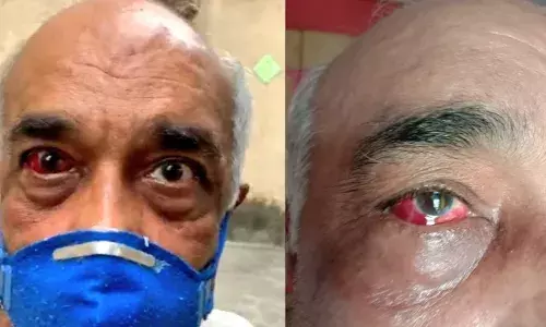 शिवसैनिकों ने की नेवी के पूर्व अफसर की जमकर पिटाई, वजह यह थी... शिवसैनिकों ने की नेवी के पूर्व अफसर की जमकर पिटाई, वजह यह थी...
