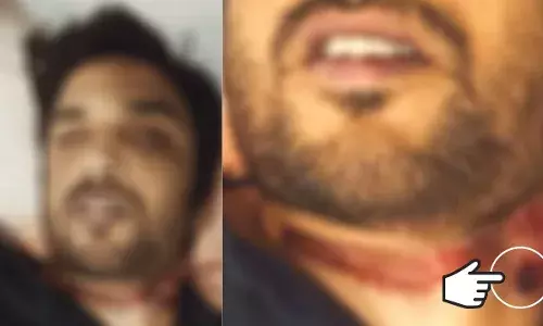 आत्महत्या के बाद सुशांत के गले के इस निशान को लेकर सोशल मीडिया पर जमकर चर्चा आत्महत्या के बाद सुशांत के गले के इस निशान को लेकर सोशल मीडिया पर जमकर चर्चा